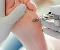 Basis pedicure Den Haag – nagels knippen en eelt verwijderen